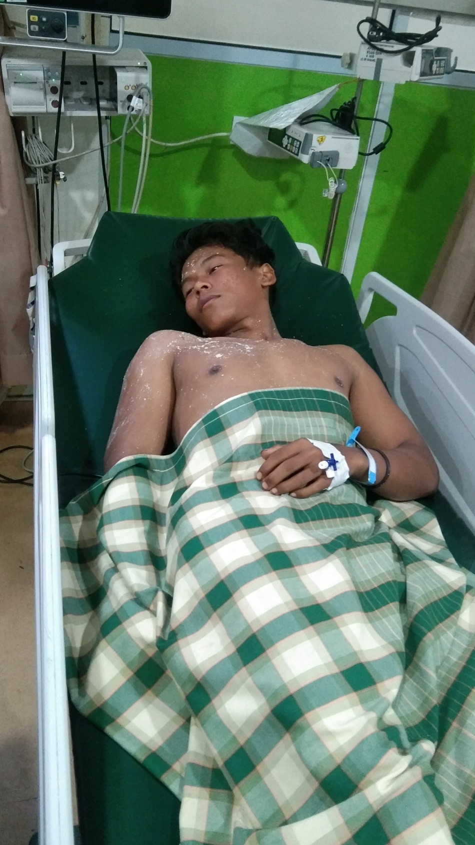 Diduga Brutal, Oknum Security KSO Aniaya Pemanen Sawit Hingga Luka Parah di Kampar